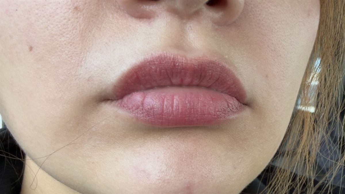 Lips Portfolio